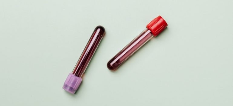 Krv unutar dve epruvete