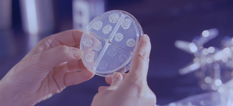 Laboratorijsi tehničar analizira bakterije u Petrijevoj šolji