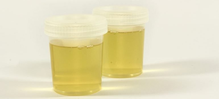 urine samples for urine tests