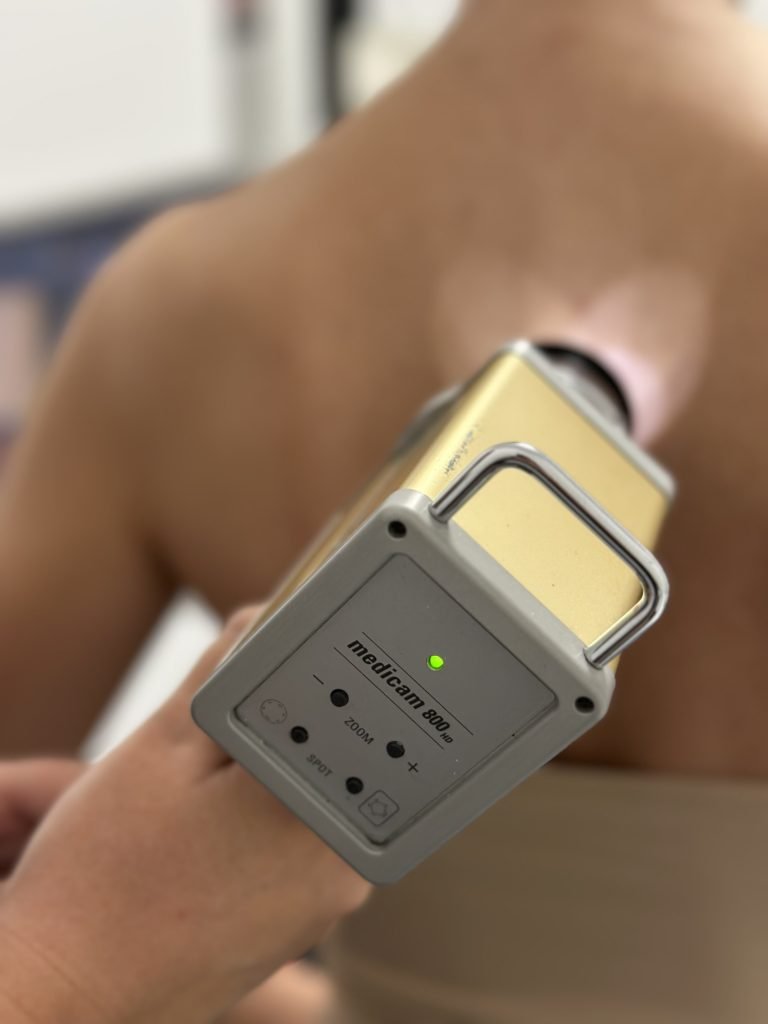 Pregled mladeža FotoFinderom