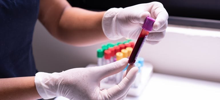 Laborantkinja drzi epruvetu sa uzorkom krvi