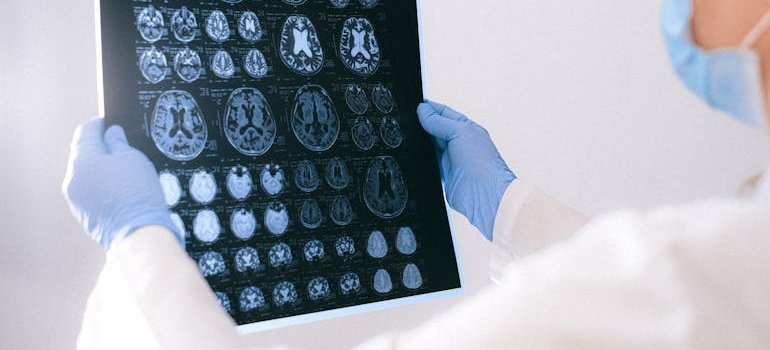 врач держит снимок головы после инсульта