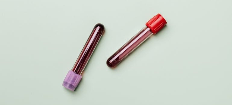 образец крови, подтверждающий синдром Вильямса